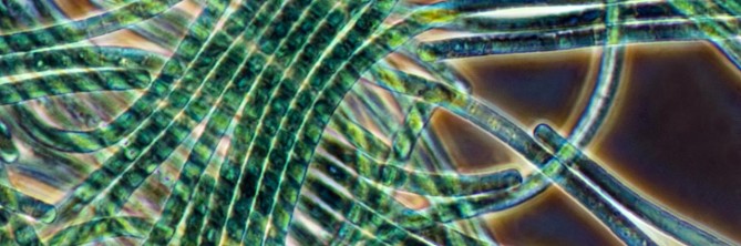 산소발생 광합성을 하는 시아노박테리아 오실라토리아 애니말리스(Oscillatoria animalis)의 현미경 사진. - 사이언스 제공